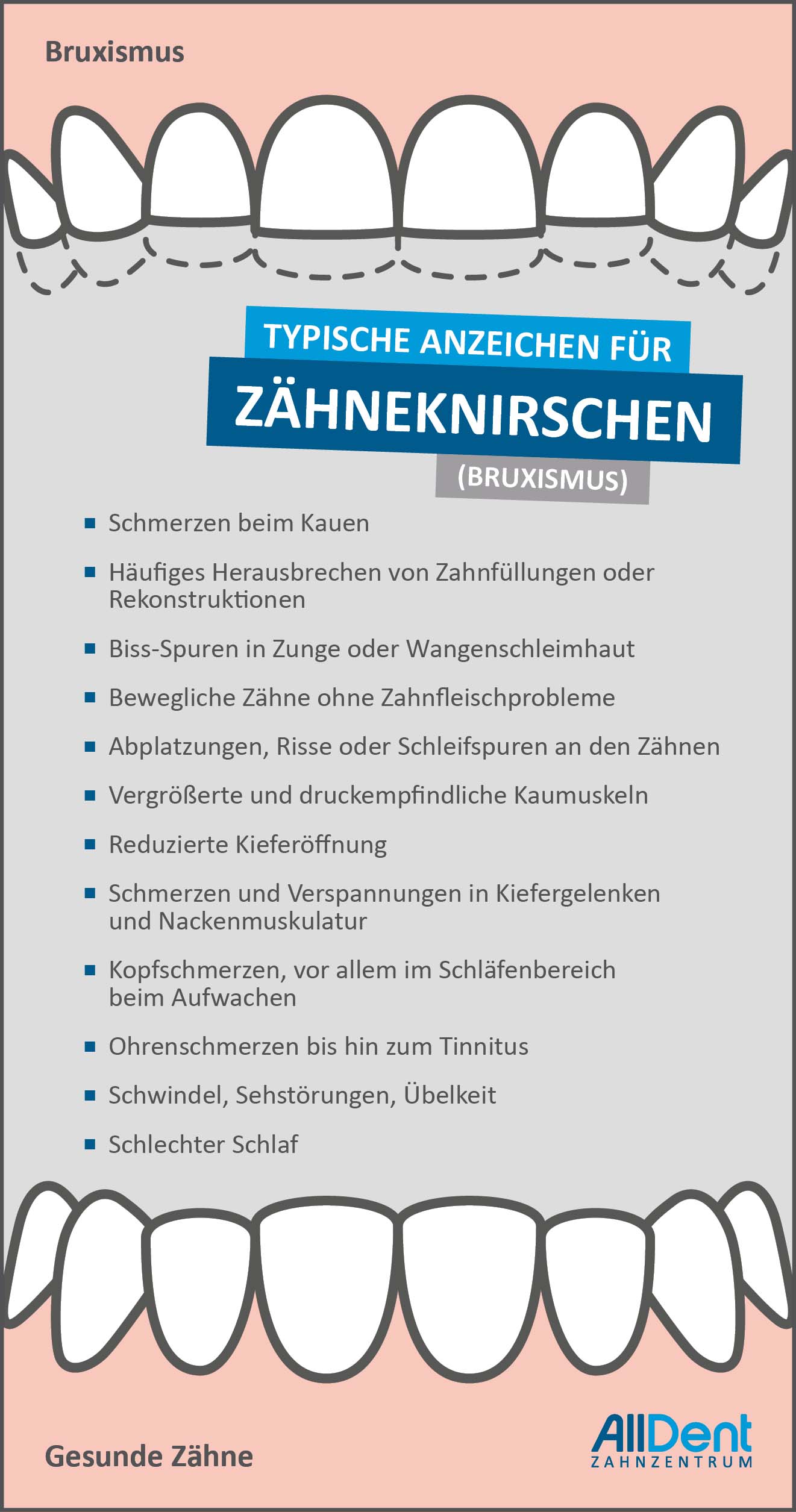 Typische Anzeichen für Zähneknirschen